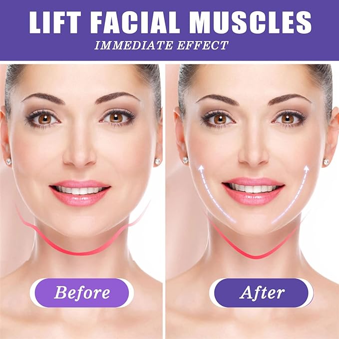 NUEVA CINTA PARA LIFTING FACIAL