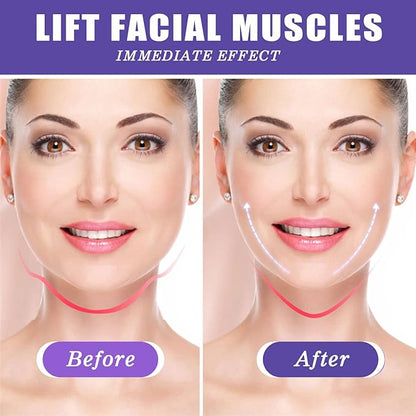 NUEVA CINTA PARA LIFTING FACIAL